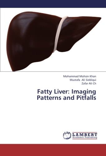 Fatty Liver: Imaging Patterns and Pitfalls