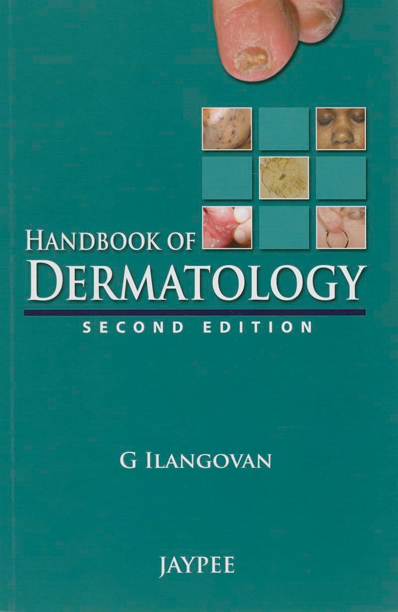 Handbook of Dermatology