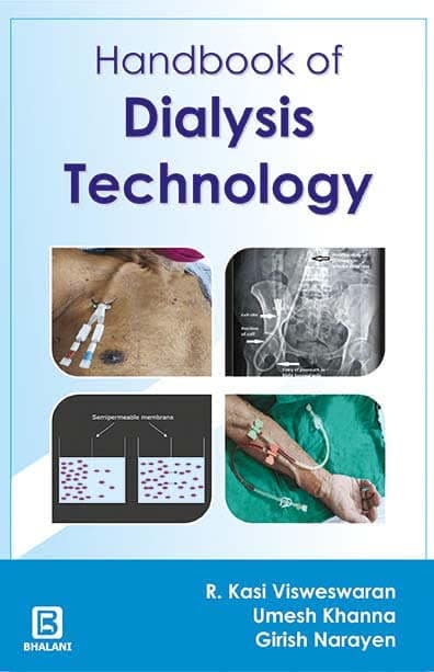 HANDBOOK OF DIALYSIS TECHNOLOGY