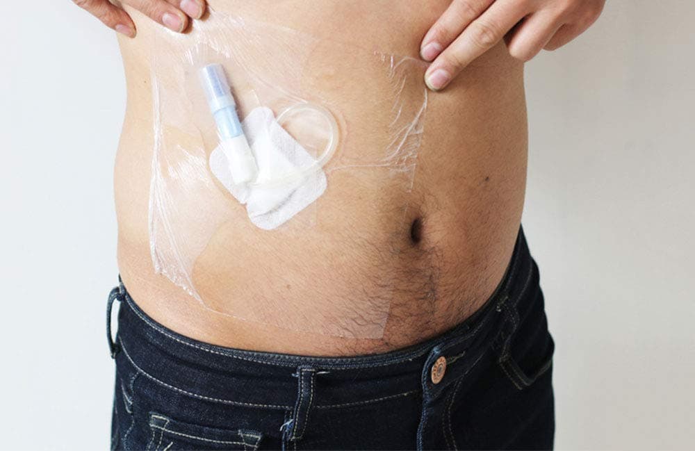 YNHUIOA Shower Shield Patch for Keep Wound Sites Dry - Waterproof Catheter Bandage Cover for Bathing - Shower Barrier(8x8in,100 Pcs)