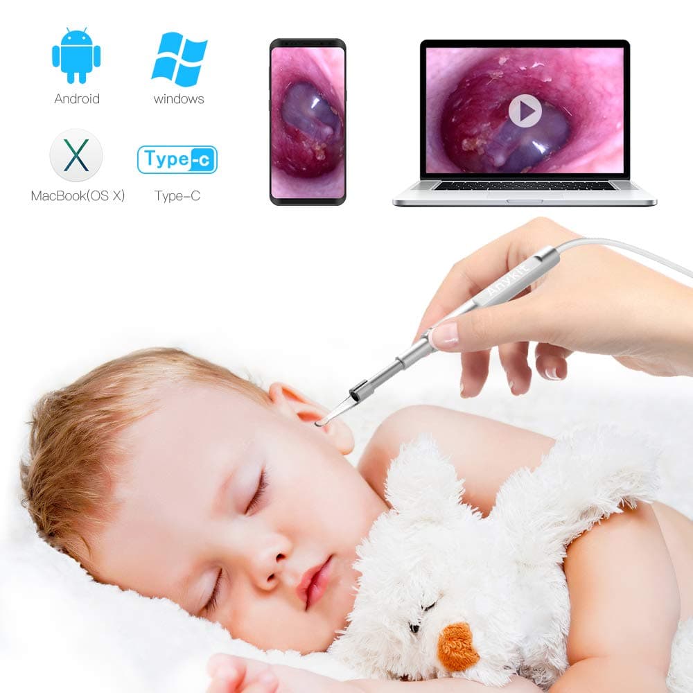 Mini Otoscope-USB Ear Camera, Anykit 3.9 mm Diameter Visual Digital Otoscope with 6 LED Lights and Earwax Removal Tool for Adult & Children, Compatiable with Phone & Tablet