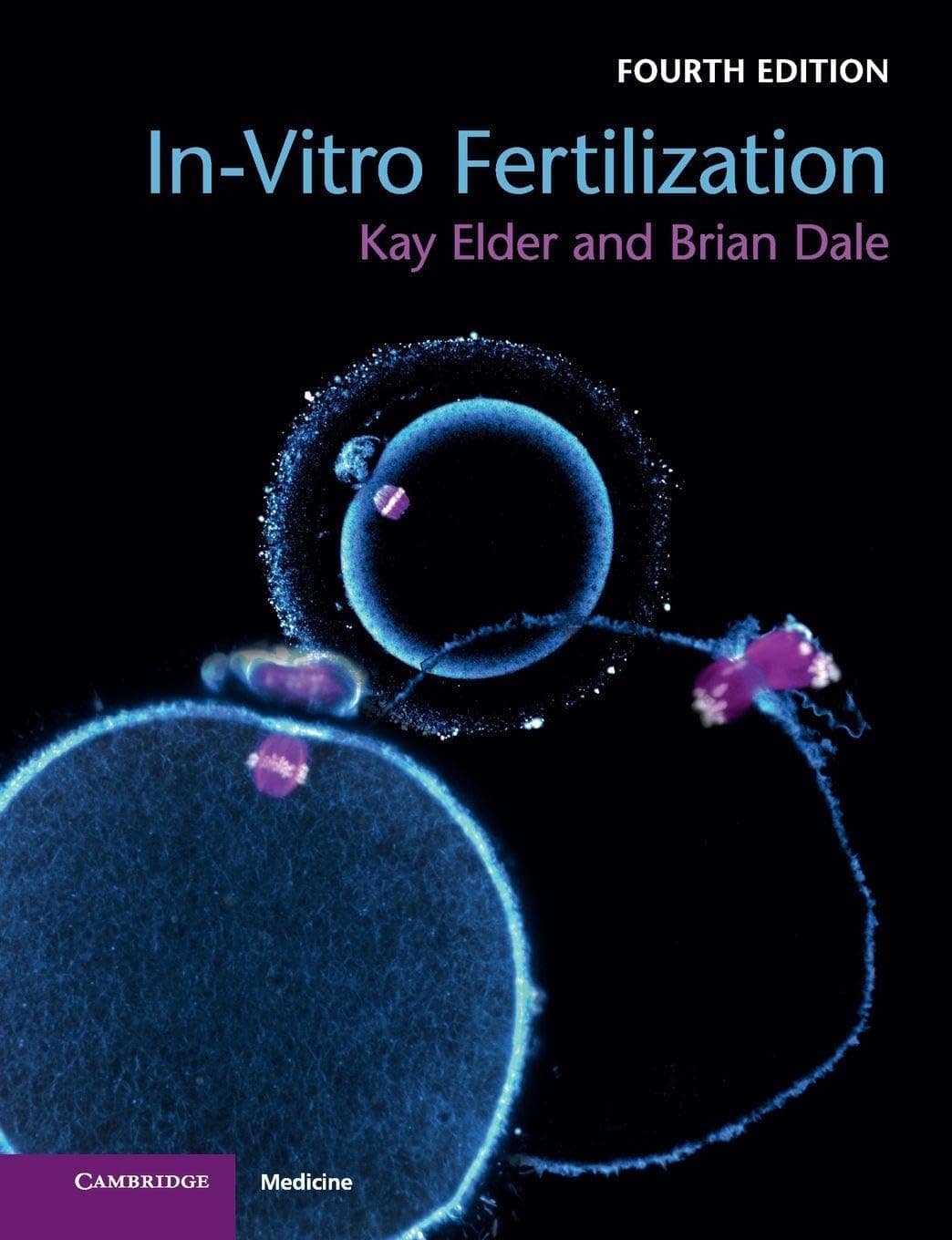 In-Vitro Fertilization Paperback – 12 March 2020