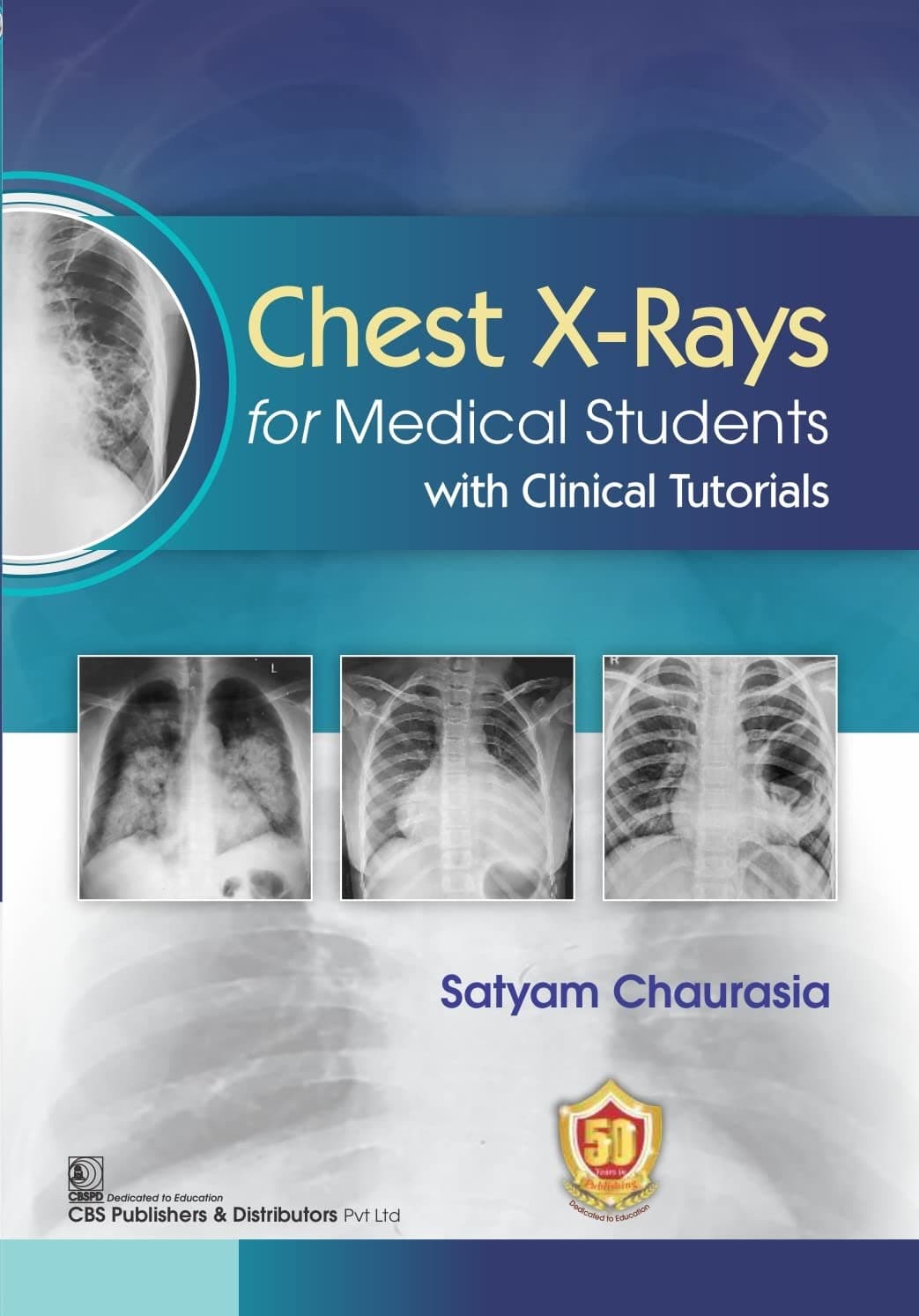 Chest X Rays For Medical Students With Clinical Tutorials (Pb 2025)
