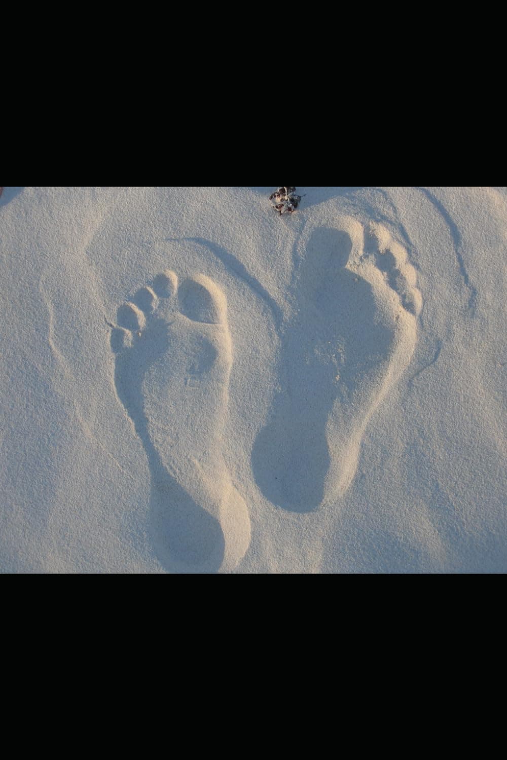 Regional Variations of Psoriasis - Volume - I