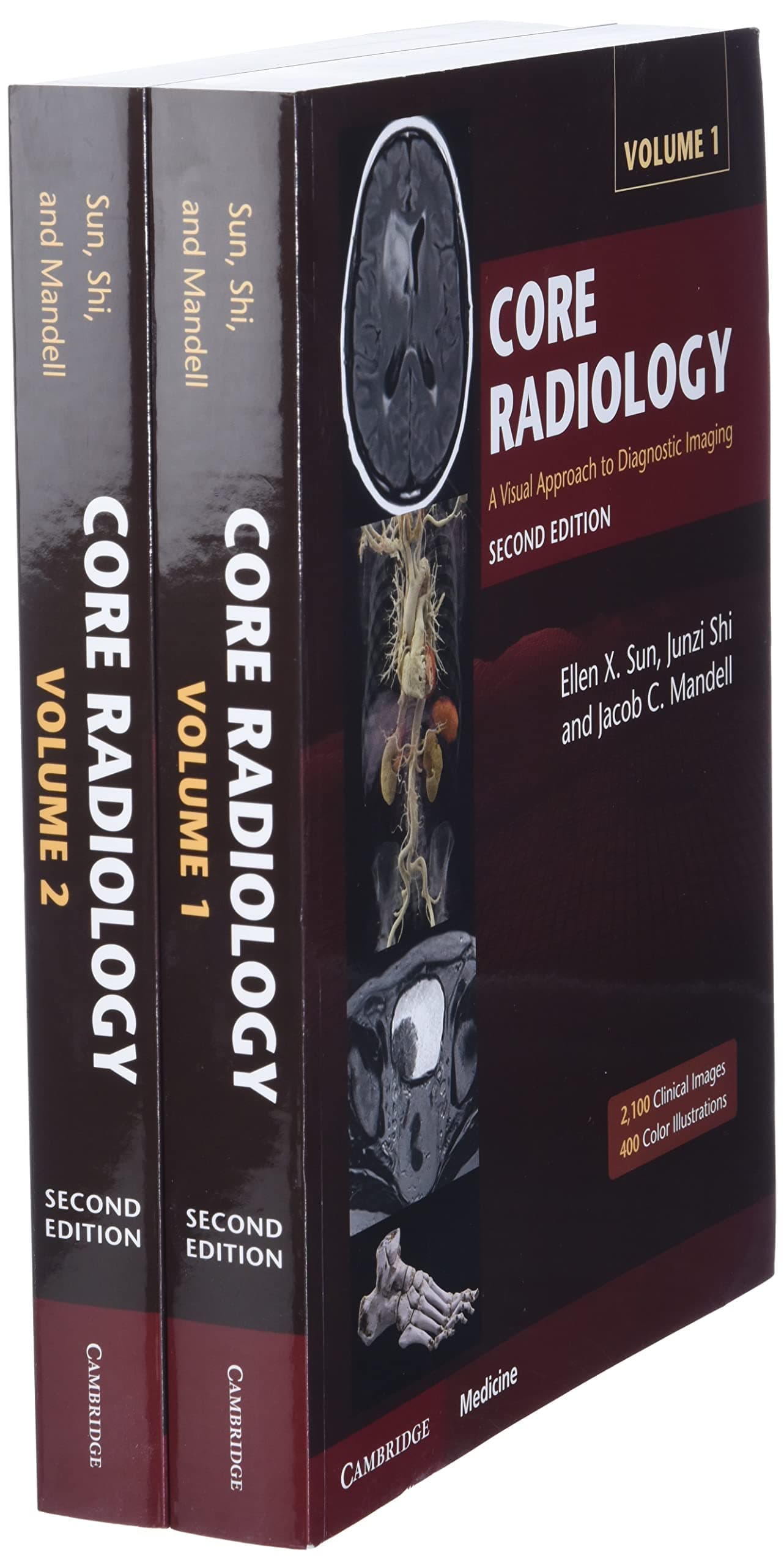 Core Radiology: A Visual Approach to Diagnostic Imaging Paperback – September 30, 2021