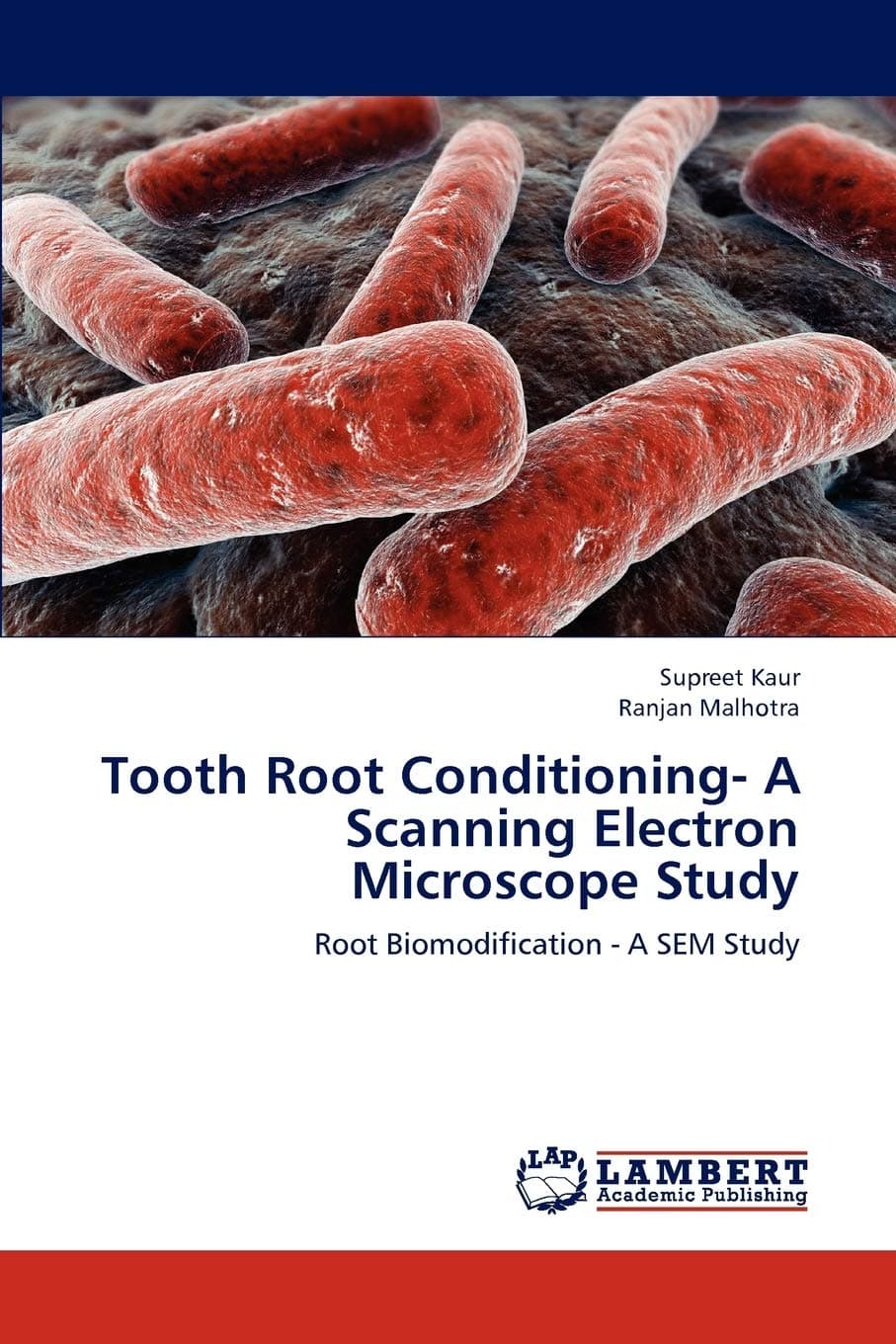 Tooth Root Conditioning- A Scanning Electron Microscope Study Paperback – Import, 10 July 2012