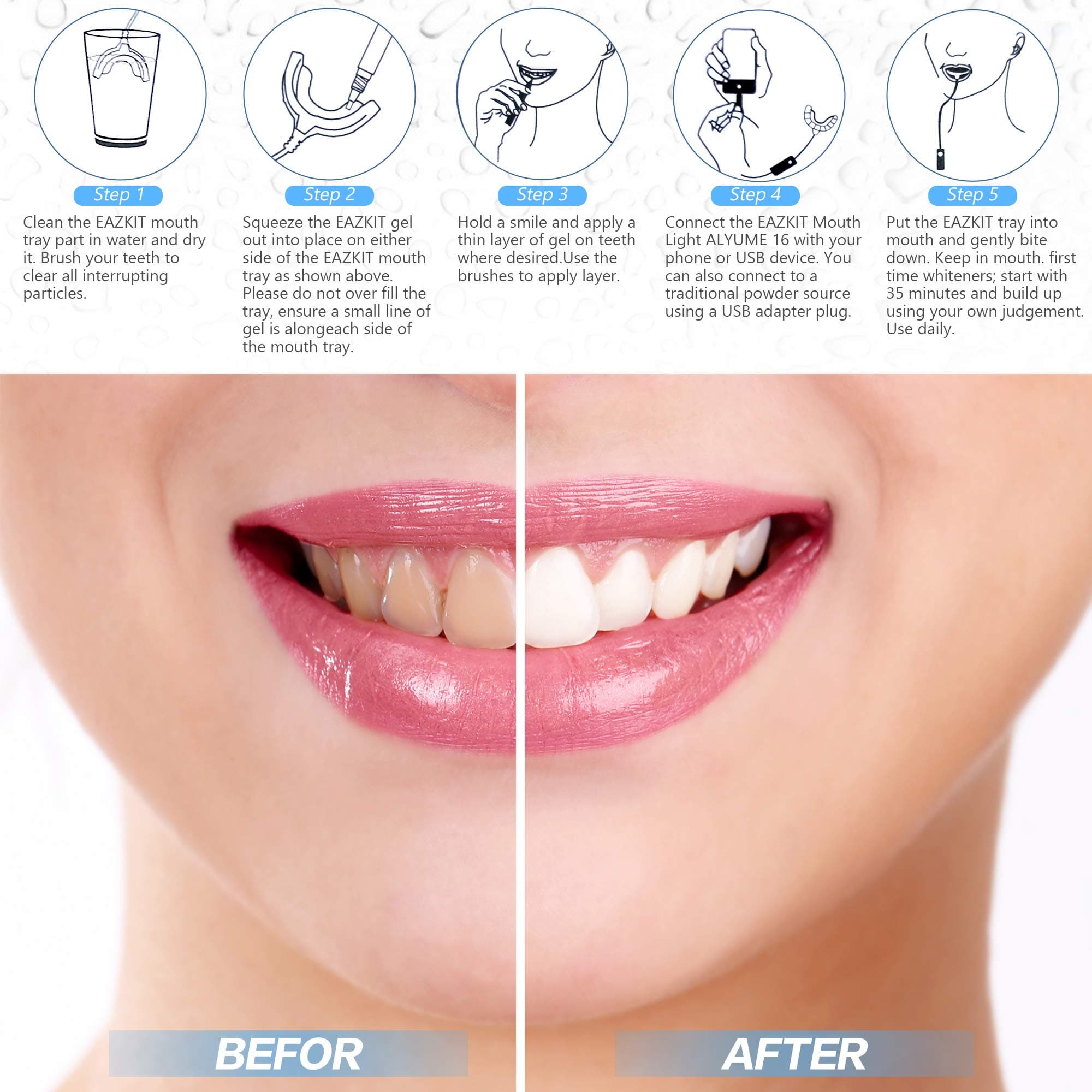 EAZKIT Teeth Whitening Kit ® HOME by Briyte Full Teeth WHITENING ALYUME 16 Light Professional Tooth Whitener Dental Care Kit Direct Gel Toothbrush x3 Bleaching Smart Phone iPhone Android USB