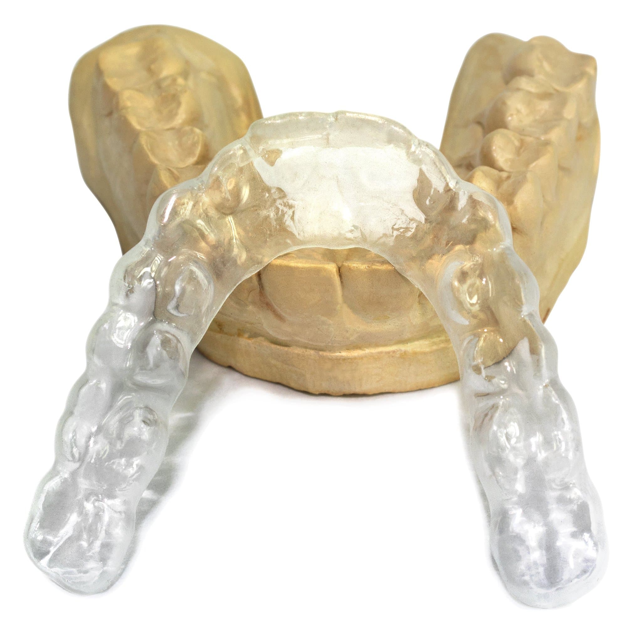 Value Protect Pro Custom Teeth Night Guard - Professional Mouth Guard for Grinding Teeth & Bruxism (Upper)