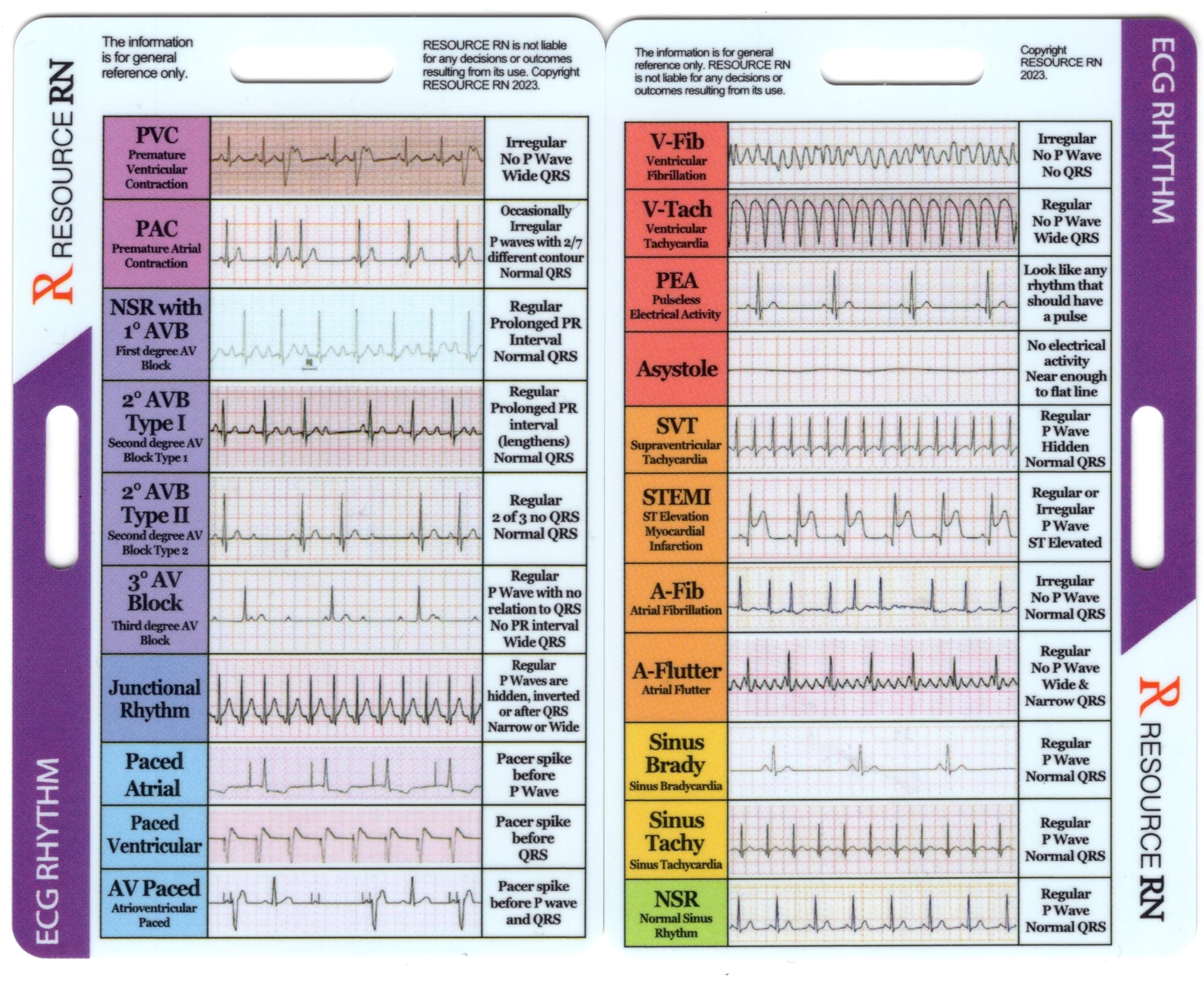 EKG Rhythm Interpretation - Compact & Portable Reference Card – Rapid Interpretation Guide – Dual Horizontal & Vertical Layout
