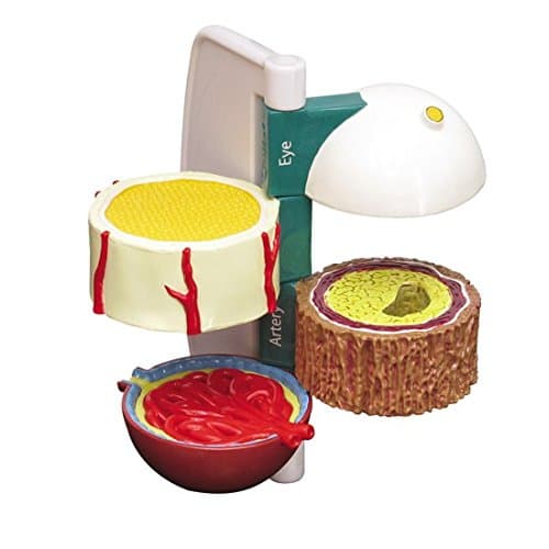 Diabetes Organ Damage 4-pc Anatomical Model